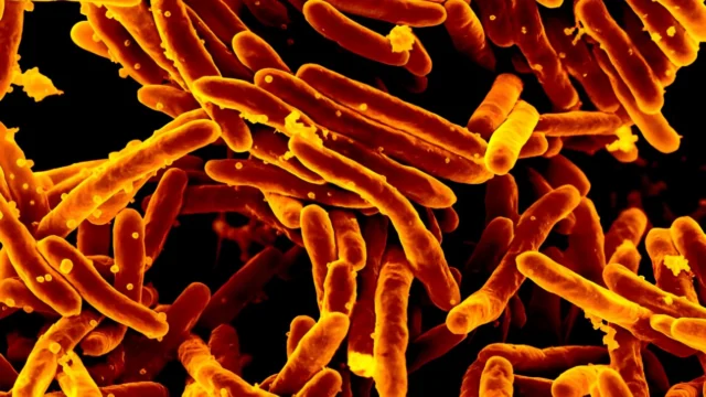 A New Era for Tuberculosis Testing: Fast, Accurate, and Phlegm-Free