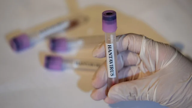 CDC Reports No Current U.S. Hantavirus Cases, Monitors 41 Individuals